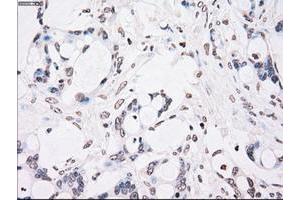 Image no. 2 for anti-Checkpoint Kinase 2 (CHEK2) antibody (ABIN1497499) (CHEK2 抗体)