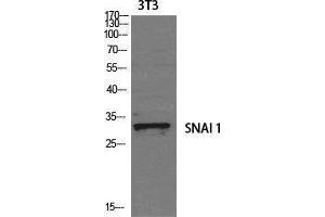 Western Blotting (WB) image for anti-SNAIL (SNAI1) (Tyr1102) antibody (ABIN3177452) (SNAIL 抗体  (Tyr1102))
