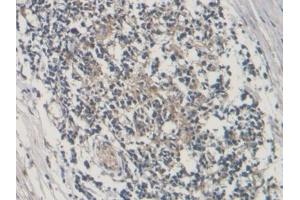 Immunohistochemistry (IHC) image for anti-Connective Tissue Growth Factor (CTGF) (AA 80-200) antibody (ABIN7437947)