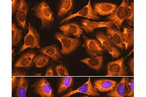 Immunofluorescence analysis of U-2 OS cells using RPS3 Polyclonal Antibody at dilution of 1:100. (RPS3 抗体)