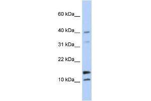 WB Suggested Anti-WFDC5 Antibody Titration: 0. (WFDC5 抗体  (N-Term))