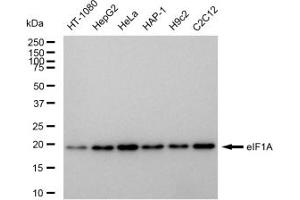 anti-Eukaryotic Translation Initiation Factor 1A (EIF1A) antibody