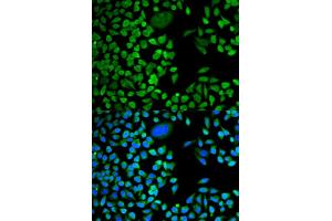 Immunofluorescence analysis of HeLa cells using TIA1 antibody. (TIA1 抗体)