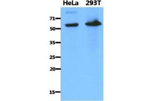 The cell lysates of HeLa (40ug) and 293T (40ug) were resolved by SDS-PAGE, transferred to PVDF membrane and probed with anti-human PDZK1 antibody (1:1000). (PDZK1 抗体)