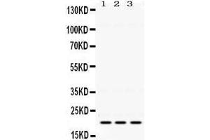 Western Blotting (WB) image for anti-HRas proto-oncogene, GTPase (HRAS) (AA 101-137), (C-Term) antibody (ABIN3043845) (HRAS 抗体  (C-Term))