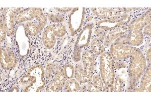 Detection of CEACAM1 in Human Kidney Tissue using Monoclonal Antibody to Carcinoembryonic Antigen Related Cell Adhesion Molecule 1 (CEACAM1) (CEACAM1 抗体)