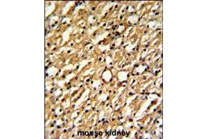 Formalin-fixed and paraffin-embedded mouse kidney reacted with DDAH1 Antibody , which was peroxidase-conjugated to the secondary antibody, followed by DAB staining. (DDAH1 抗体  (C-Term))