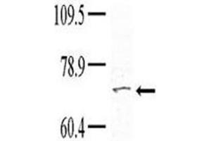 Western blot analysis of TNK1 antibody (1:100) in HeLa lysate; Courtesy of Dr.