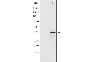 Western blot analysis of I kappaB epsilon phosphorylation expression in TNF-a treated Jurkat whole cell lysates,The lane on the left is treated with the antigen-specific peptide.