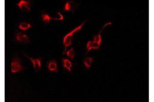 Immunofluorescence (fixed cells) (IF/ICC) image for anti-Apoptosis Antagonizing Transcription Factor (AATF) (N-Term) antibody (ABIN6256888)