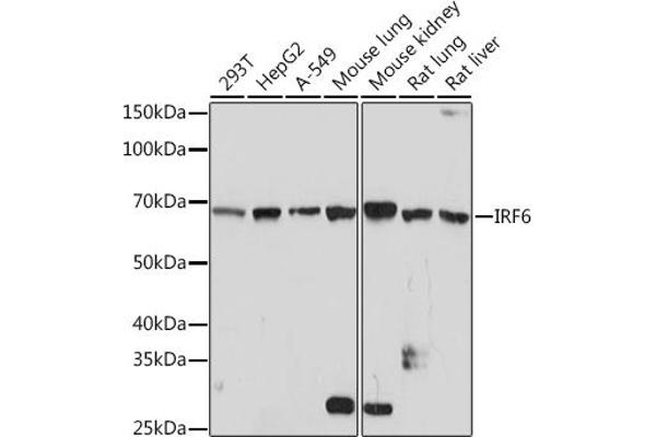 IRF6 抗体