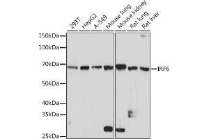 Western blot analysis of extracts of various cell lines, using IRF6 Rabbit mAb (ABIN1680921, ABIN3017588, ABIN3017589 and ABIN7101507) at 1:1000 dilution. (IRF6 抗体)