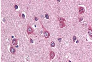 Human Brain, Cortex (formalin-fixed, paraffin-embedded) stained with PAK3 antibody ABIN337352 at 10 ug/ml followed by biotinylated goat anti-rabbit IgG secondary antibody ABIN481713, alkaline phosphatase-streptavidin and chromogen. (PAK3 抗体  (N-Term))