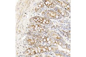Immunohistochemistry of paraffin embedded rat duodenum using TAF4 (ABIN7075827) at dilution of 1:450 (300x lens) (TAF4 抗体)