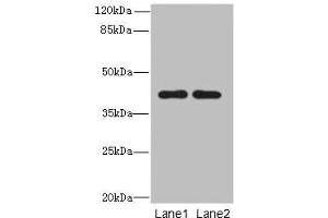 Western blot All lanes: CIPC antibody at 6 μg/mL Lane 1: A431 whole cell lysate Lane 2: NIH/3T3 whole cell lysate Secondary Goat polyclonal to rabbit IgG at 1/10000 dilution Predicted band size: 43 kDa Observed band size: 43 kDa (CIPC/KIAA1737 抗体  (AA 1-399))