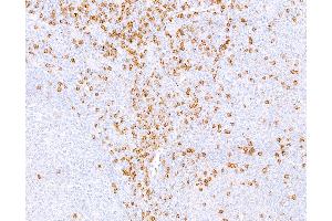 Immunohistochemistry (IHC) image for anti-CD8a Molecule (CD8A) (C-Term), (Cytoplasmic Domain) antibody (ABIN7449043) (CD8 alpha 抗体  (C-Term, Cytoplasmic Domain))