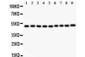 Western Blotting (WB) image for anti-Myc Proto-Oncogene protein (MYC) (AA 257-439) antibody (ABIN3043598)