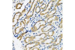 Immunohistochemistry of paraffin-embedded rat kidney using SLC23A2 antibody (ABIN5974077) at dilution of 1/100 (40x lens). (SLC23A2 抗体)