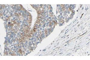 ABIN6276977 at 1/100 staining Human prostate tissue by IHC-P. (TCP1 alpha/CCTA 抗体  (C-Term))