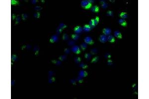 Immunofluorescence staining of Hela cells with ABIN7147175 at 1:50, counter-stained with DAPI. (CD63 抗体  (AA 103-203))