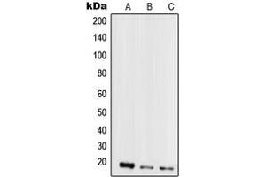 Western blot analysis of Mammaglobin A expression in MCF7 (A), MDAMB435 (B), HeLa (C), HepG2 (D) whole cell lysates. (Mammaglobin A 抗体  (Center))
