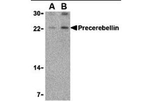 Western Blotting (WB) image for anti-Cerebellin 1 Precursor (CBLN1) (Middle Region) antibody (ABIN1031046) (CBLN1 抗体  (Middle Region))