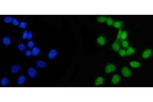 IF analysis of APRT using anti-APRT antibody (ABIN4886471). (APRT 抗体  (N-Term))