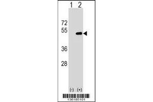 Western blot analysis of FNTA using rabbit polyclonal FNTA Antibody using 293 cell lysates (2 ug/lane) either nontransfected (Lane 1) or transiently transfected (Lane 2) with the FNTA gene. (FNTA 抗体  (N-Term))