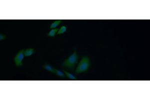 Detection of HSPA1B in Human HepG2 cell using Polyclonal Antibody to Heat Shock 70 kDa Protein 1B (HSPA1B) (HSPA1B 抗体  (AA 1-642))