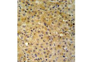 Immunohistochemistry (Paraffin-embedded Sections) (IHC (p)) image for anti-NADH Dehydrogenase (Ubiquinone) 1 alpha Subcomplex, 10, 42kDa (NDUFA10) (AA 259-289), (Middle Region) antibody (ABIN953628)
