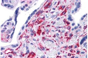 Human Placenta: Formalin-Fixed, Paraffin-Embedded (FFPE) (STAT5B 抗体  (AA 180-229))