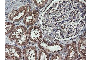 Image no. 2 for anti-Mitogen-Activated Protein Kinase Kinase 1 (MAP2K1) antibody (ABIN1499394) (MEK1 抗体)