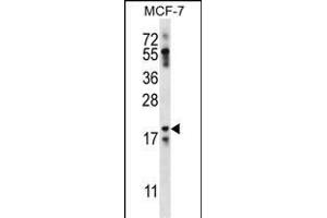 NRN1L Antibody (Center) (ABIN656859 and ABIN2846064) western blot analysis in MCF-7 cell line lysates (35 μg/lane). (Neuritin 1-Like 抗体  (AA 40-69))