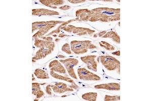 (ABIN6242395 and ABIN6577138) staining MKRN2 in human heart tissue sections by Immunohistochemistry (IHC-P - paraformaldehyde-fixed, paraffin-embedded sections). (MKRN2 抗体)