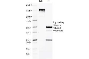 SDS-PAGE Analysis Purified CD50 Mouse Monoclonal Antibody (CG106). (ICAM-3/CD50 抗体)
