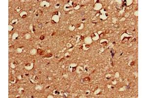 Immunohistochemistry (IHC) image for anti-Protein Kinase, CAMP Dependent, Catalytic, beta (PRKACB) (AA 2-53), (Catalytic Subunit beta) antibody (ABIN7146602)