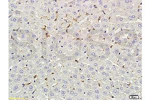Formalin-fixed and paraffin embedded rat liver labeled with Rabbit Anti-phospho-CD32B(Tyr292) Polyclonal Antibody (ABIN761411) at 1:200 followed by conjugation to the secondary antibody and DAB staining. (FCGR2B 抗体  (pTyr292))