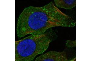 Confocal immunofluorescence analysis of A549 cells using DDR2 mouse mAb (green). (DDR2 抗体)