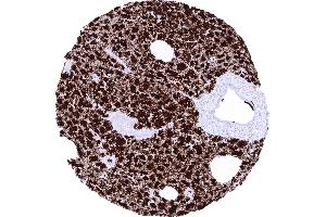 Pancreas (GP2 抗体  (AA 35-179))