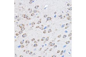 Immunohistochemistry (IHC) image for anti-Protein Tyrosine Phosphatase, Non Receptor Type 23 (PTPN23) (AA 1230-1450) antibody (ABIN1682396)