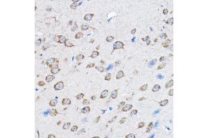 Immunohistochemistry of paraffin-embedded mouse brain using PTPN23 Rabbit pAb (ABIN1682396, ABIN3019081, ABIN3019082 and ABIN6220704) at dilution of 1:100 (40x lens). (PTPN23 抗体  (AA 1230-1450))