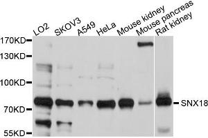 Western blot analysis of extracts of various cell lines, using SNX18 antibody (ABIN5998918) at 1/1000 dilution. (SNX18 抗体)