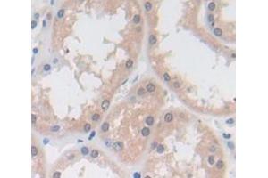 IHC-P analysis of Human Tissue, with DAB staining. (Vitamin D-Binding Protein 抗体  (AA 18-211))