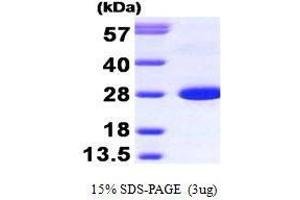 Figure annotation denotes ug of protein loaded and % gel used. (CALB1 Protein (AA 1-261))