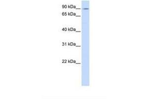 Image no. 1 for anti-ATPase, Ca++ Transporting, Type 2C, Member 1 (ATP2C1) (C-Term) antibody (ABIN6738121)