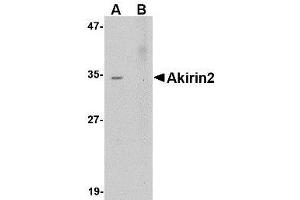 Western blot analysis of Akirin2 in Human Brain tissue lysate with AP30041PU-N Akirin2 antibody at 0. (AKIRIN2 抗体  (Center))