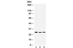 Western blot testing of 1) rat testis, 2) human 22RV1 and 3) human SKOV lysate with Smac antibody. (DIABLO 抗体  (AA 56-239))
