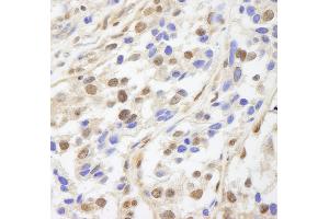 anti-Uveal Autoantigen With Coiled Coil Domains And Ankyrin Repeats (UACA) (AA 675-725) antibody