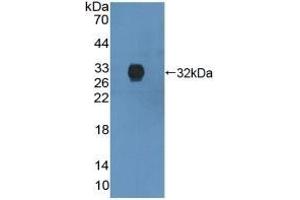 Detection of Recombinant ANXA6, Human using Polyclonal Antibody to Annexin A6 (ANXA6) (ANXA6 抗体  (AA 2-251))