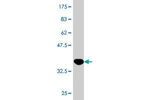 Western Blot detection against Immunogen (36. (KLF8 抗体  (AA 1-98))